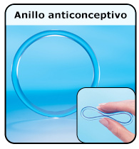 Anillo anticonceptivo