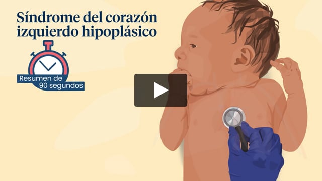 Resumen de 90 segundos: Síndrome del corazón izquierdo hipoplásico