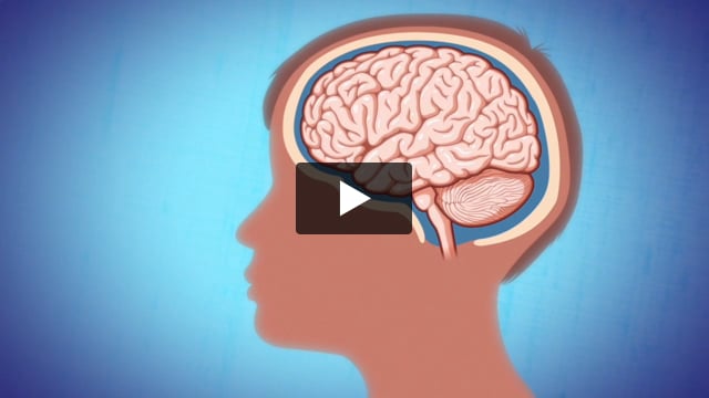 Conmociones Cerebrales
