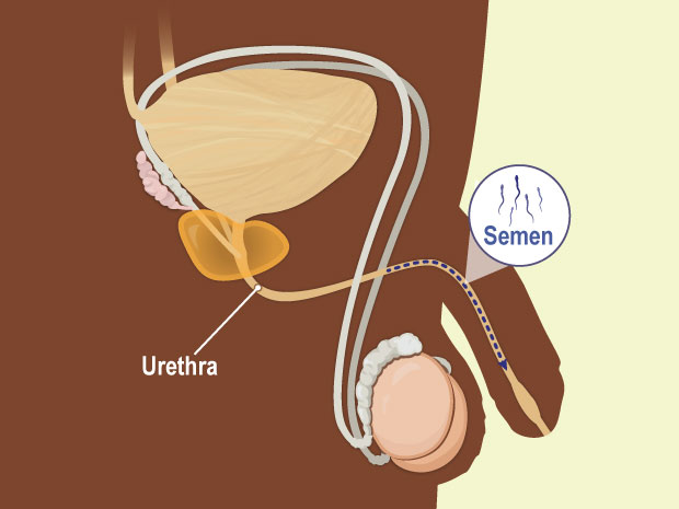 When semen gets pushed out the urethra, it's called ejaculation.