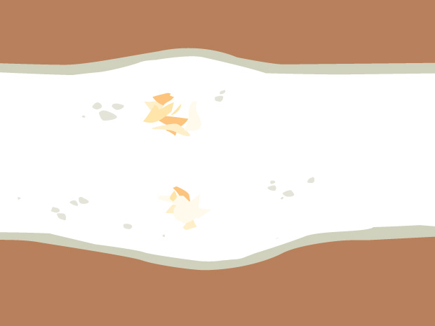 Curación continuaEl hueso nuevo continúa formándose y endureciéndose. El hueso lentamente retoma su forma.