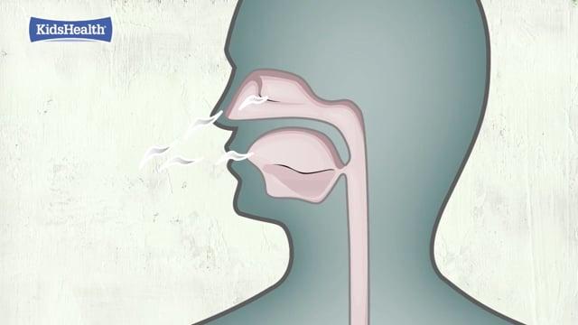 Ataques de asma: ¿Qué sucede?