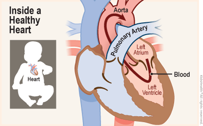 Two diagrams show the position of the heart in the body and a close-up, cross section of a healthy heart. Blood flows from the left atrium into the left ventricle and through a valve into the aorta. 