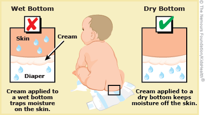 diaper rash illustration
