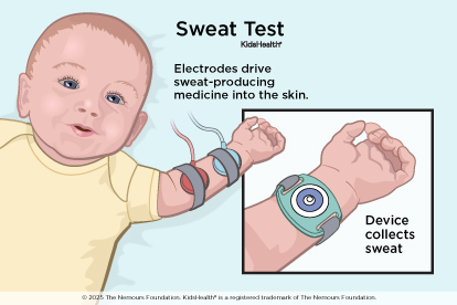 Child undergoing sweat test
