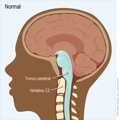 Se muestra una corte transversal de un tronco cerebral normal y la vértebra C2.